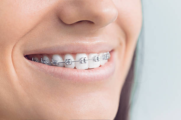 Why Choose Us for Your Dental Needs in Glenmora, LA
